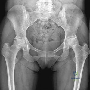 Orthopedic Basic Science MCQs: Decode what illustration a shows