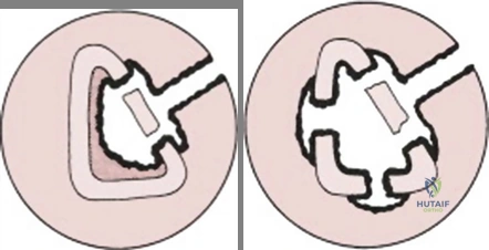 Clinical Image