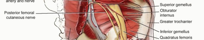 Illustration 3 for Total Hip Arthroplasty: Journey to Preventing Complications