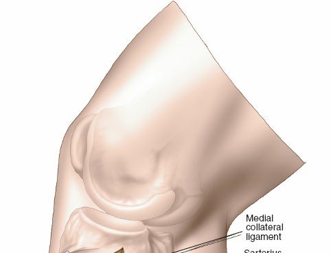 Illustration 21 for Surgical Access: Mastering the Tibia's Surface & Fibula Approaches