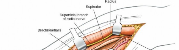 Illustration 15 for Mastering Approaches to the Upper Third of the Radius