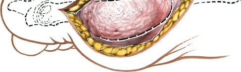 Illustration 202 for Optimized Approaches to the Dorsum of the Foot & Ankle