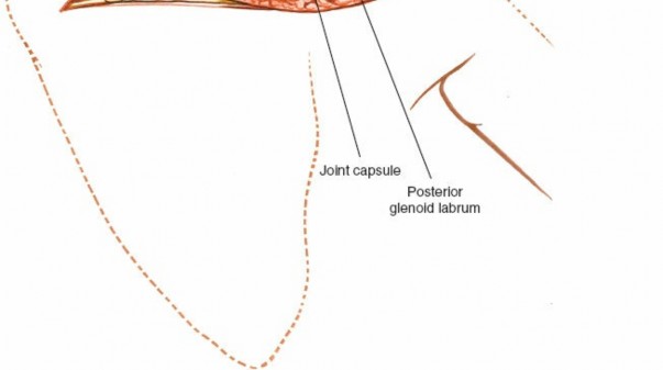 Illustration 184 for Essential Guide: Mastering Every Approach to the Shoulder