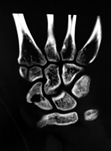 صورة طبية: دليل الأستاذ الدكتور محمد هطيف الشامل لأمراض وإصابات اليد والمعصم في صنعاء