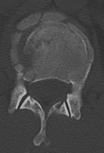Illustration 32 for Master Orthopedic Spine Cases: Sharpen Your Diagnostic Skills