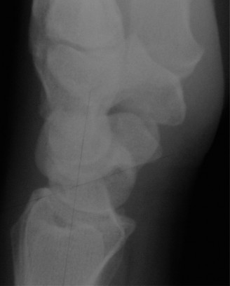 Illustration 7 for Unlock Wrist Diagnosis: Cases Guided by Figure Sunil Thirkannad