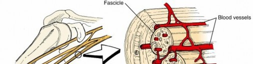 Illustration of tissue and intervertebral - Dr. Mohammed Hutaif