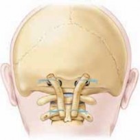 Illustration 20 for Cervical Fusion: The Line is Drawn for Lasting Stability