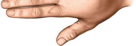 Illustration 205 for Essential Surgical Approaches: Uncover Every Aspect of the Wrist