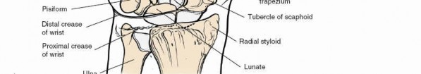 Illustration 85 for Volar Approach: Optimal Exposure for the Volar aspect of the Distal Radius