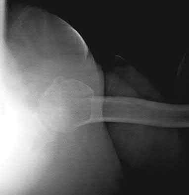 Illustration 181 for OrthoCash: Trauma MCQs & Cases for a yearold woman