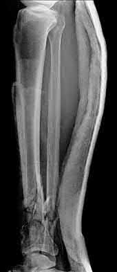 Illustration 148 for OrthoCash: Trauma MCQs & Cases for a yearold woman