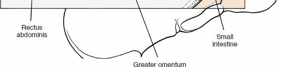 Illustration 116 for Approach to the Lumbar Spine: Mastering Techniques & Anatomy