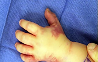 صورة طبية: دليل الأستاذ الدكتور محمد هطيف الشامل لأمراض وإصابات اليد والمعصم في صنعاء