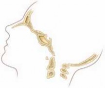 Illustration 5 for Cervical Fusion: The Line is Drawn for Lasting Stability