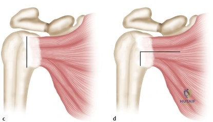 Trauma Orthopedic Teaching Cases