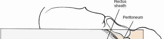 Illustration 111 for Approach to the Lumbar Spine: Mastering Techniques & Anatomy
