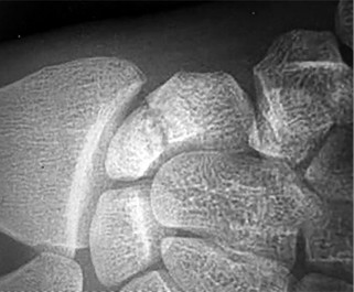 صورة طبية: دليل الأستاذ الدكتور محمد هطيف الشامل لأمراض وإصابات اليد والمعصم في صنعاء