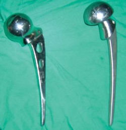 Illustration 7 for Mastering Hip Arthroplasty: Its Evolution and Design Unveiled