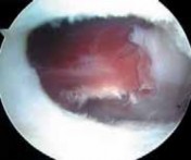 Illustration 29 for J. W. Thomas on Snapping Hip: Causes, Cures & Relief