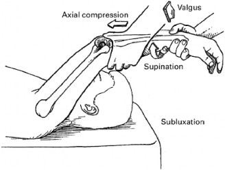 Illustration 105 for Acad Orthop Surg Challenge: Diagnose Shoulder Pain Case 1