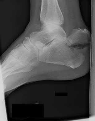 Illustration 208 for OrthoCash: Trauma MCQs & Cases for a yearold woman