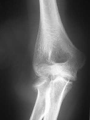Illustration 200 for OrthoCash: Trauma MCQs & Cases for a yearold woman