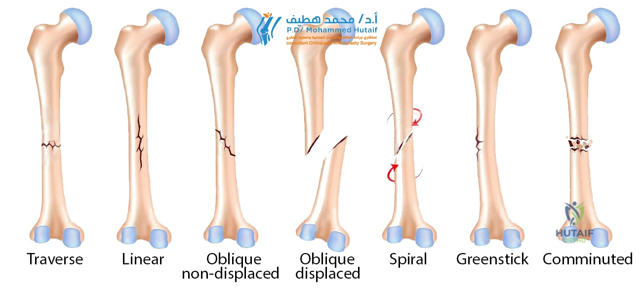 Best orthopedic surgeon Yemen