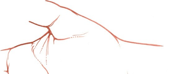 Illustration 36 for Volar Approach: Optimal Exposure for the Volar aspect of the Distal Radius