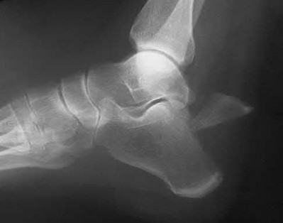 Illustration 92 for OrthoCash: Trauma MCQs & Cases for a yearold woman