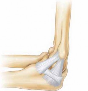 Illustration of arthroscopic valgus instability - Dr. Mohammed Hutaif