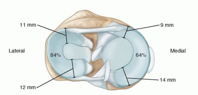 Illustration of meniscal repair meniscal - Dr. Mohammed Hutaif