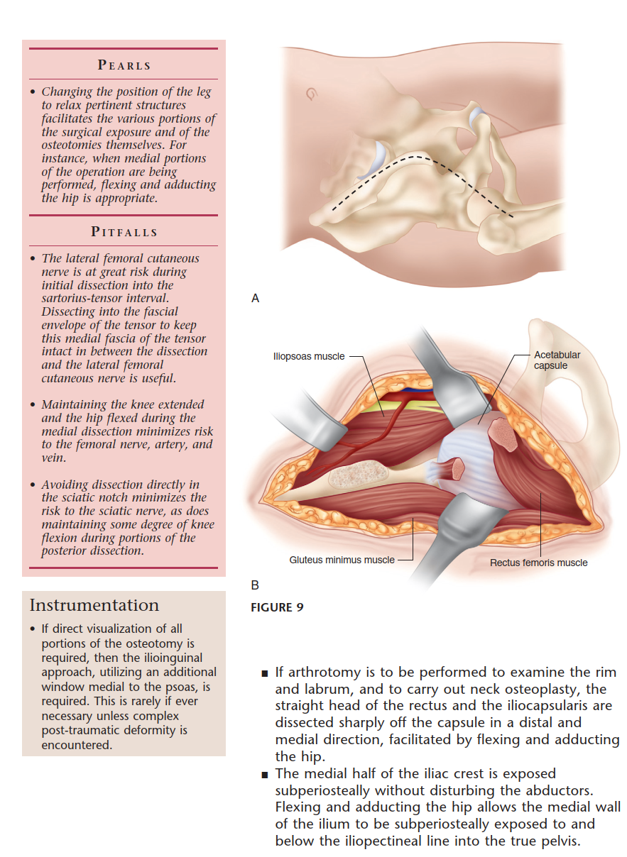 Illustration 23 for Bernese PAO: Unlocking the Procedure with Level V Evidence Insights
