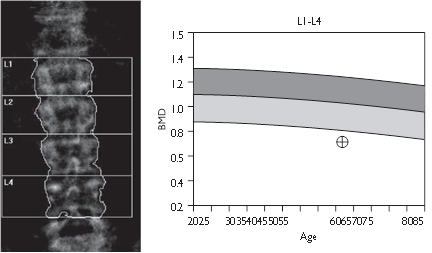 Illustration 12 for Pass Your Basic Sciences Viva: Key Anatomy & Pathology