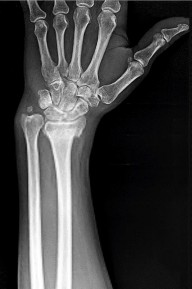 صورة توضيحية لـ دليل الأستاذ الدكتور محمد هطيف الشامل لأمراض وإصابات اليد والمعصم في صنعاء