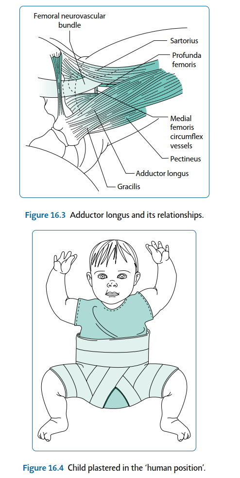 Crucial Positioning for General Anaesthesia in Pediatric Orthopaedics