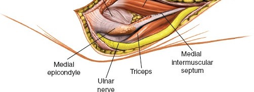 Illustration 88 for Mastering the Approach to the Distal Humerus: Safety & Skills