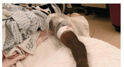 Illustration 6 for Distal Radius Fixation: Precision Through Lister's Tubercle