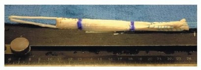 Illustration 3 for Posterior Cruciate Ligament Surgery: Regain Knee Strength & Stability