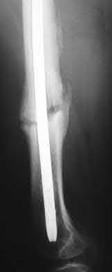 Illustration 125 for OrthoCash: Trauma MCQs & Cases for a yearold woman