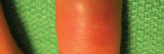 Illustration 7 for Orthopedic Hand Cases: A Patient's Journey, Is a Year Old a Factor?