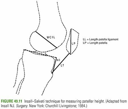 Illustration 39 for Master Pediatric Femoral Shaft & Knee Fractures: Interactive Module