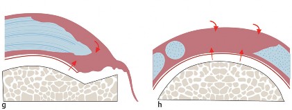 Shoulder Ultrasound: Patient & Probe for Efficient, Precise Scans