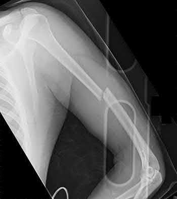 Illustration 131 for OrthoCash: Trauma MCQs & Cases for a yearold woman