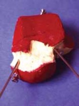 Illustration 20 for Talar Neck Fracture Treatment: Optimizing Recovery with ORIF