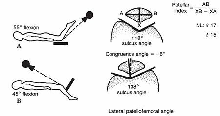Illustration 36 for Master Pediatric Femoral Shaft & Knee Fractures: Interactive Module