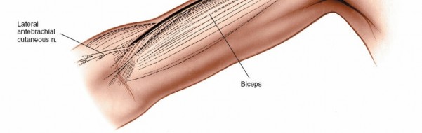 Illustration 4 for Mastering the Approach to the Distal Humerus: Safety & Skills