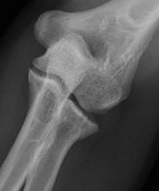 Illustration 35 for OrthoCash: Trauma MCQs & Cases for a yearold woman