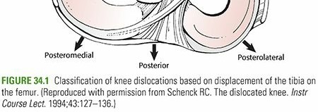 Illustration of knee dislocation femorotibial - Dr. Mohammed Hutaif
