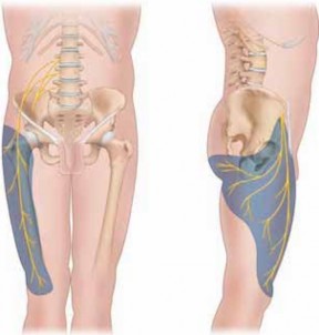 Illustration of peroneal and lateral - Dr. Mohammed Hutaif
